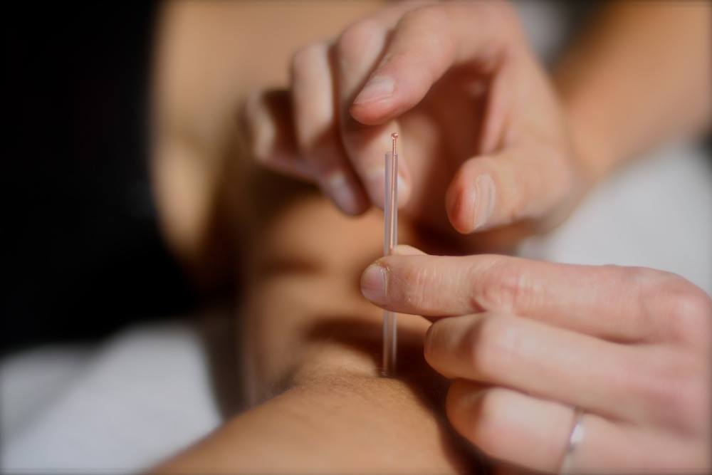 Le Centre Ka Yoga Acupuncture