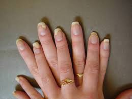 R K Ayurvedic And Psoriasis Research Centre Vijayawada