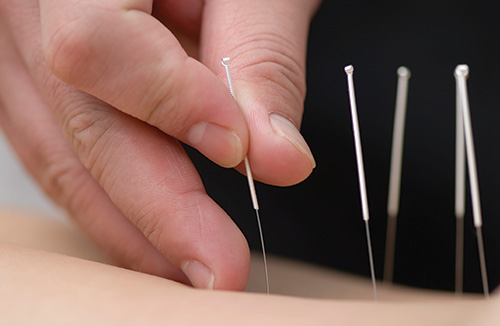 Life Ready Physio and Pilates Bicton Perth