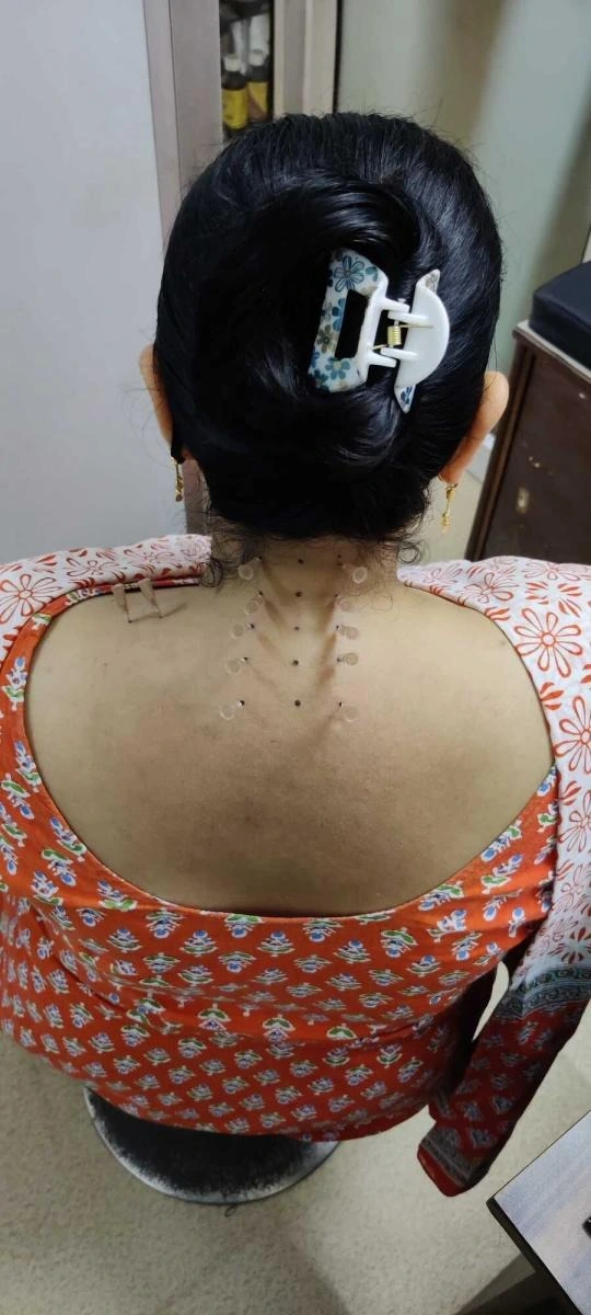  India